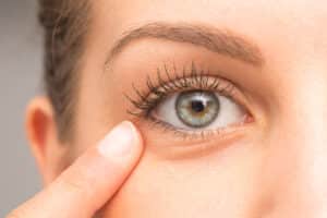 A close-up shot of a woman pointing to her under-eye area